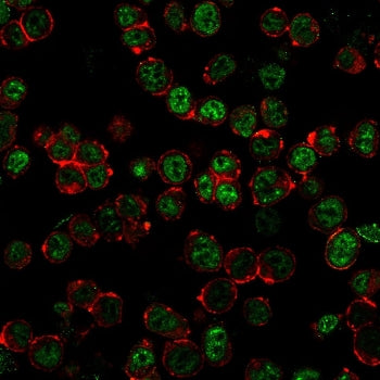 Neurofilament Antibody Cocktail (Heavy + Light)