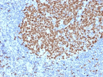 IHC testing of FFPE human tonsil stained with Ki67 antibody (MKI67/2463). Required HIER: boiling tis