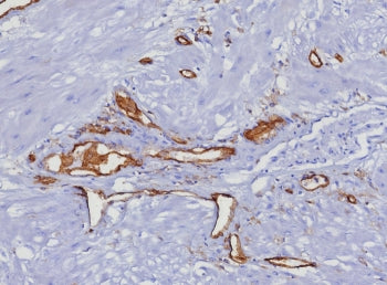 CD31 Antibody / PECAM-1