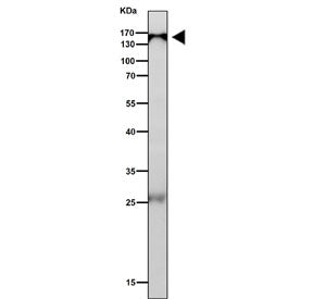 Western blot testing of mouse lung tissue lysate with IPO9 antibody. Predicted molecular weight ~116