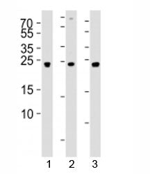 Western blot analysis of lysate from 1) 293, 2) SW620, and 3) U-87 MG cell line using UCHL3 antibody