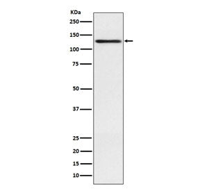 Western blot testing of human A431 cell lysate with Involucrin antibody. Predicted molecular weight 