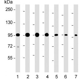 Western blot testing of human 1) HeLa, 2) HT-29, 3) K562, 4) LNCaP, 5) mouse brain, 6) mouse liver a
