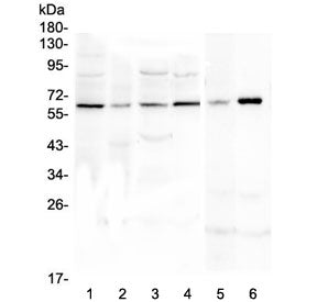 Western blot testing of human 1) U-87 MG, 2) SHG-44, 3) MDA-MB-231, 4) K562, 5) rat C6 and 6) mouse 