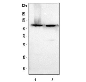 RECK Antibody / Reversion-inducing cysteine-rich protein with Kazal motifs, 100ug