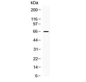 Western blot testing of mouse brain lysate with CKAP4 antibody at 0.5ug/ml. Predicted molecular weight ~64 kDa.