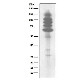 Western blot testing of human Jurkat cell lysate with Phosphotyrosine antibody. Phosphotyrosine-cont