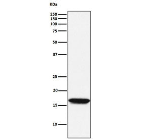 Western blot testing of human Jurkat cell lysate with NME1 antibody. Predicted molecular weight ~17 
