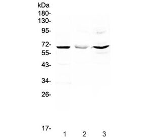 Western blot testing of 1) rat liver, 2) mouse HEPA1-6 and 3) human HeLa lysate with CD5 antibody at
