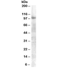 Western blot testing of A549 lysate with FGFR2 antibody at 0.3ug/ml. Predicted molecular weight of m