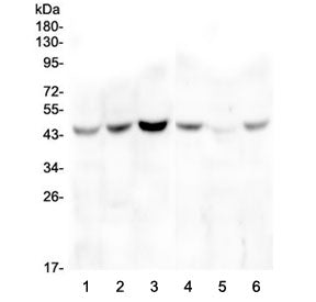 Western blot testing of human 1) HeLa, 2) placenta, 3) A549, 4) T-47D, 5) PC-3 and 6) U-2 OS cell ly