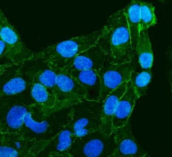 Immunofluorescent staining of FFPE human HeLa cells with Gamma Catenin antibody (green) and DAPI nuc