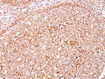 IHC: Formalin-fixed, paraffin-embedded human tonsil stained with anti-CD79a antibody (clone SPM550).