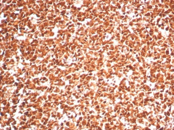 IHC staining of FFPE human tonsil tissue with Proliferating Cell Nuclear Antigen antibody (clone PCN