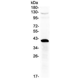 Western blot testing of human placenta lysate with HSD17B1 antibody at 0.5ug/ml. Predicted molecular