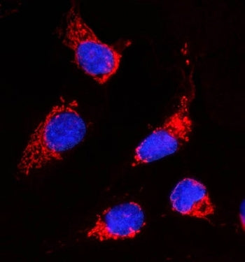Acetyl CoA Carboxylase 1 Antibody / ACACA