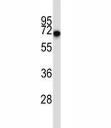 CD5 antibody western blot analysis in ZR-75-1 lysate. Observed molecular weight 55~67 kDa depending 