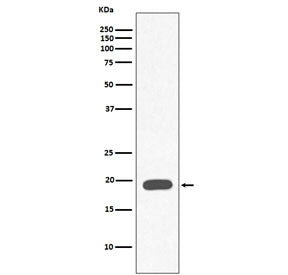 Western blot testing of human heart lysate with Myoglobin antibody. Predicted molecular weight ~17 k
