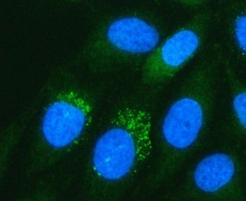 Immunofluorescent staining of FFPE human HeLa cells with PADI3 antibody (green) and DAPI nuclear sta