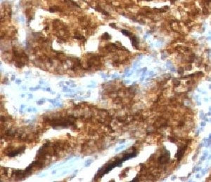 TAG-72 Antibody