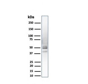 PSMD4 Antibody
