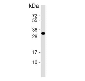 Western blot testing of human MCF7 cell lysate with Latexin antibody. Predicted molecular weight ~26