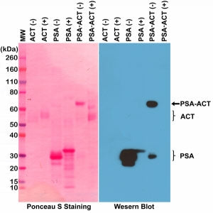 Western blot testing of PSA (purified from human seminal fluid), ACT (alpha 1-antichymotrypsin, from