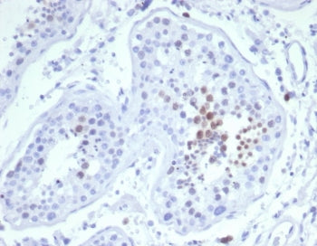 KIF2C Antibody / MCAK