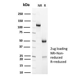 SDS-PAGE analysis of purified, BSA-free CD7 antibody (clone HuLy-m2) as confirmation of integrity an