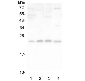 Western blot testing of human 1) placenta, 2) SMMC-7721, 3) A375 and 4 A431 lysate with LMO2 antibod