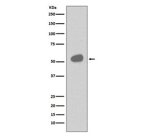 Western blot testing of human tonsil lysate with CD14 antibody. Expected molecular weight 40-55 kDa 