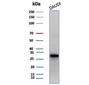 Haptoglobin Antibody