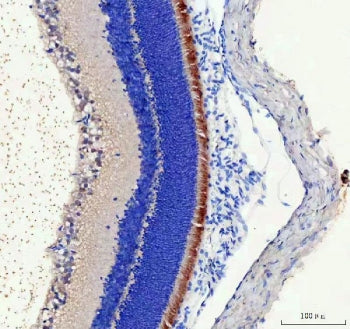 IHC staining of FFPE rat retina tissue with IMPG2 antibody. HIER: boil tissue sections in pH8 EDTA f