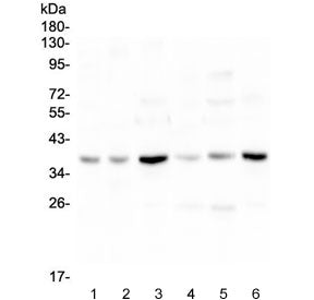 Western blot testing of 1) rat brain, 2) rat heart, 3) rat liver, 4) mouse brain, 5) mouse heart and