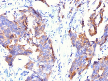 IHC testing of FFPE human stomach with MUC1 antibody (clone 115D8). HIER: requires steaming of secti