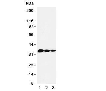 Western blot testing of T-bet antbody and human recombinant protein, 35KD with tag; Lane 1: 5ng; 2: 