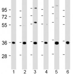 Western blot testing of human 1) A431, 2) HeLa, 3) HepG2, 4) Jurkat, 5) U-2OS and 6) SH-SY5Y cell ly