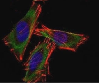 Confocal Immunofluorescent analysis of A2058 cells using Alexa Fluor 488-labeled S100B antibody (gre