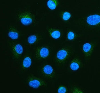 Immunofluorescent staining of FFPE human A549 cells with PMP70 antibody (green) and DAPI nuclear sta