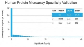 Analysis of HuProt(TM) microarray containing more than 19,000 full-length human proteins using Clust
