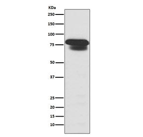 Western blot testing of human HepG2 cell lysate with PIAS1/2/3 antibody. Predicted molecular weight: