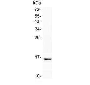 Western blot testing of human SK-OV-3 cell lysate with NPC2 antibody at 0.5ug/ml. Predicted molecula