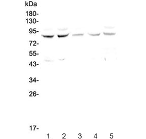 Western blot testing of human 1) HeLa, 2) COLO-320, 3) MDA-MB-231, 4) Jurkat and 5) PANC-1 cell lysa