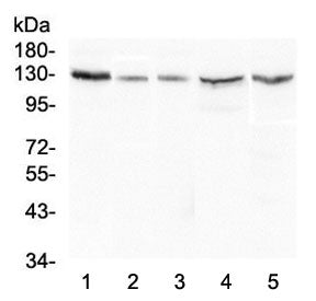 Western blot testing of human 1) HeLa, 2) A549, 3) 22RV1, 4) HepG2 and 5) Caco-2 lysate with CASR an