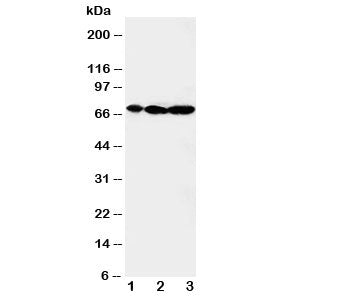 Western blot testing of MEKK2 antibody and Lane 1: rat brain; 2: rat testis; 3: rat lung tissue lysa