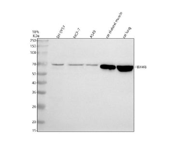 Western blot analysis of FBXW8 using anti-FBXW8 antibody. Electrophoresis was performed on a 10% SDS