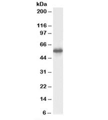 Western blot testing of human testis lysate with CSN1 antibody at 0.5ug/ml. Predicted molecular weight: ~58kDa.
