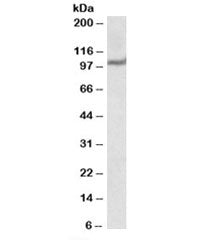 Western blot testing of human heart lysate with USP4 antibody at 1ug/ml. Predicted molecular weight: