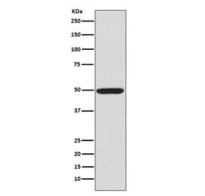 Western blot testing of human K562 cell lysate with phospho-PKA R2 antibody (pS99). Predicted molecu