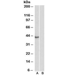 Western blot testing of HeLa nuclear [A] and cytosolic [B] lysate with TBP antibody at 0.3ug/ml. Pre
